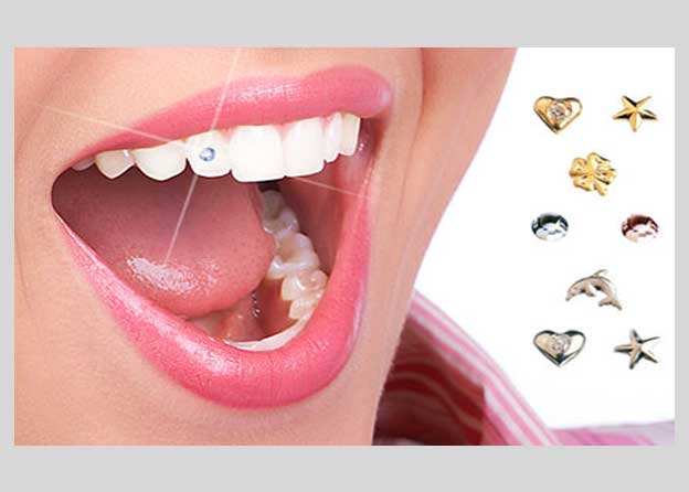 Tooth jewellery - Orocare