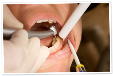 Conservative dentistry and Endodontics - Orocare